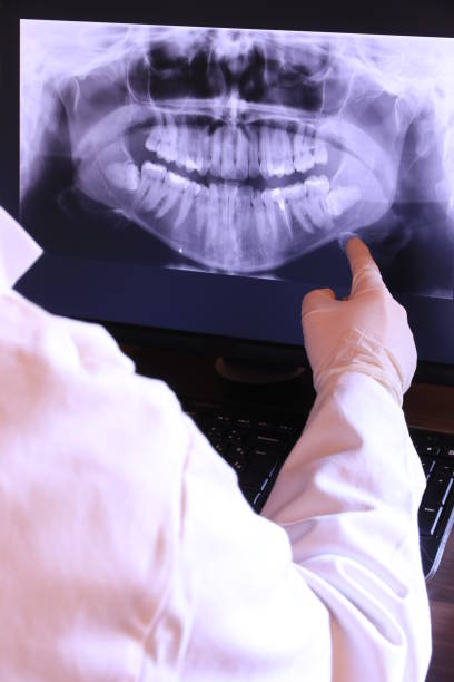 Best Emergency Root Canal Treatment in Whiteland, IN