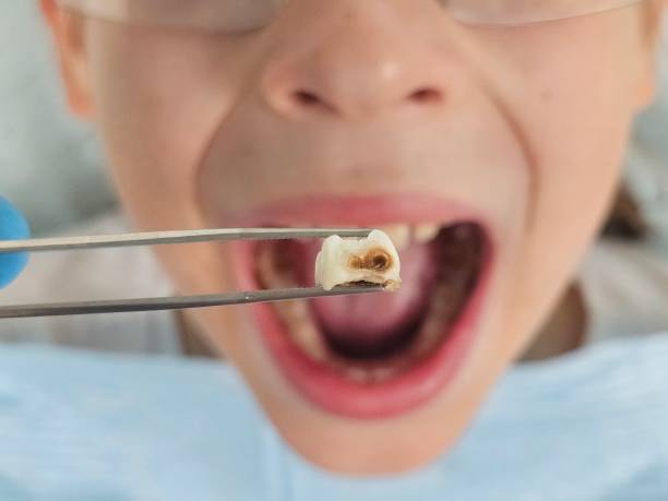 Best Emergency Dentist for Special Needs Patients in Whiteland, IN