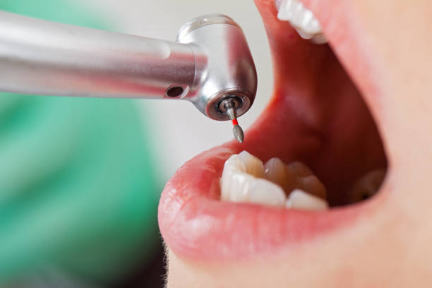 Best Emergency Dentist for Knocked-Out Tooth in Whiteland, IN